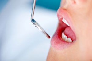 routine dental care