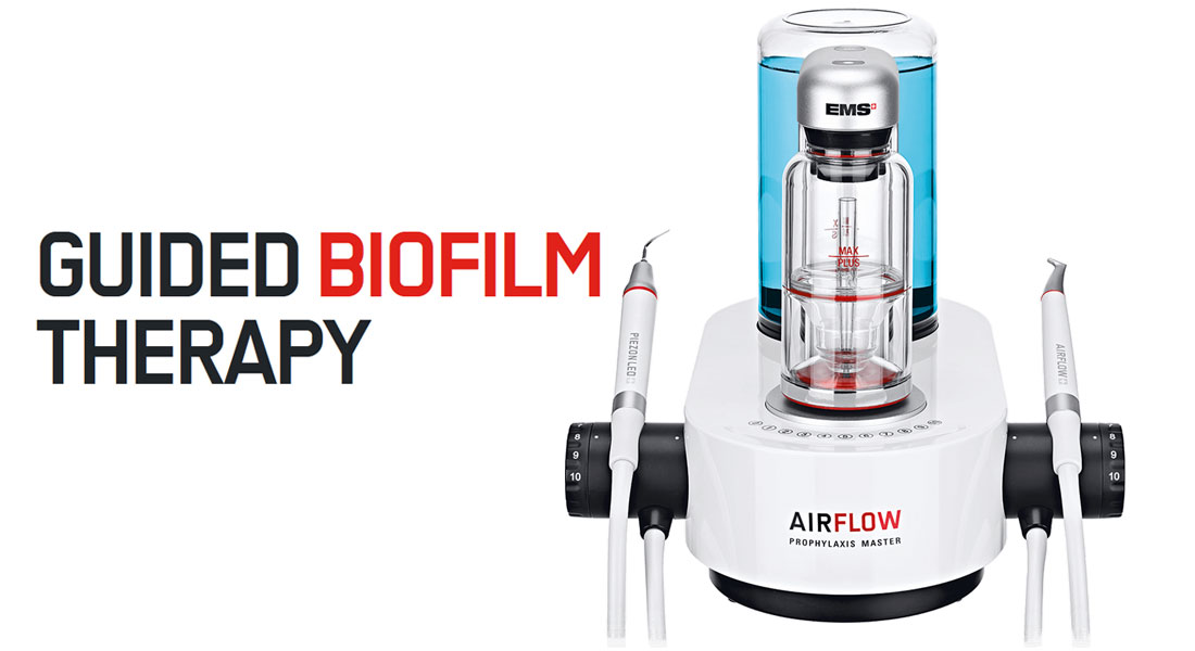 GUIDED BIOFILM
THERAPY