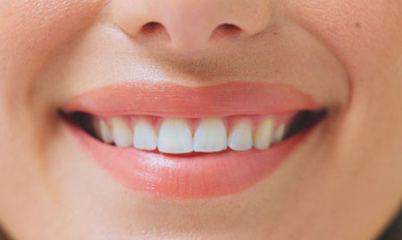 Implant Maintenance in Broomfield, CO