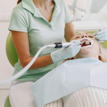 deep teeth cleaning