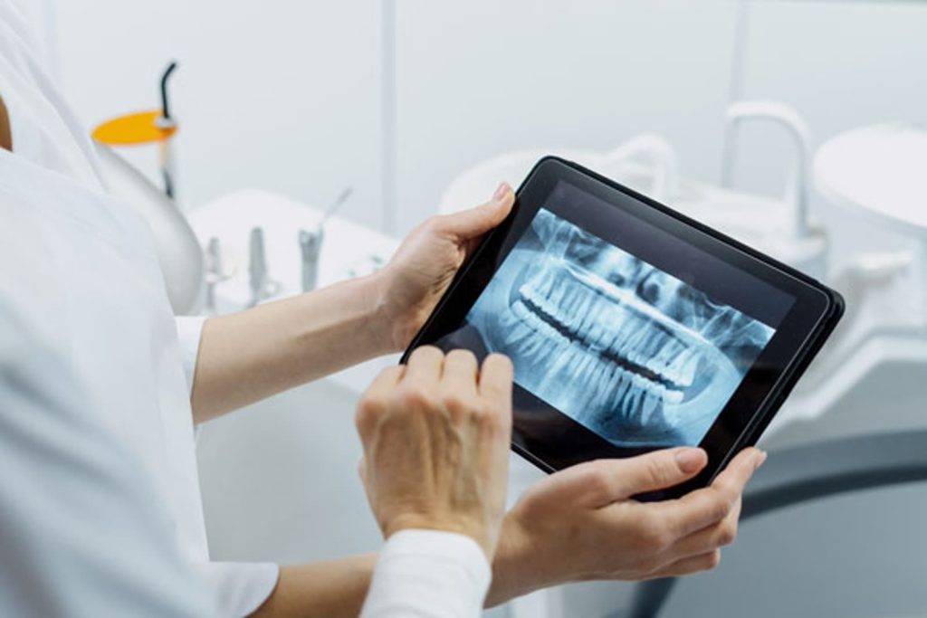 Digital X-rays & Oral Cancer Screening